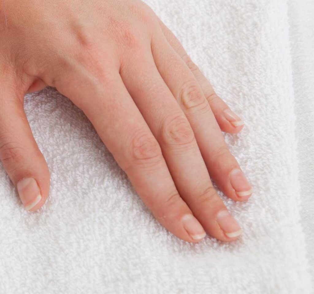 Rejuvenecimiento de Manos, Bioestimulador