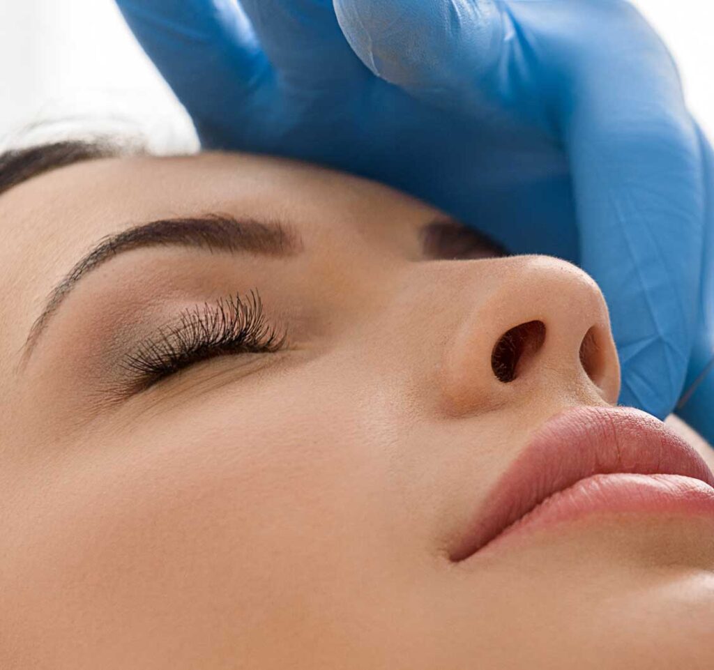 Rinomodelación, Modificación Nasal