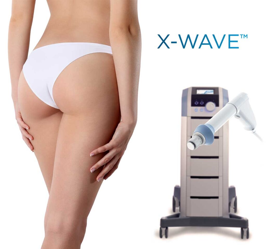 X-Wave™ Ciudad de México