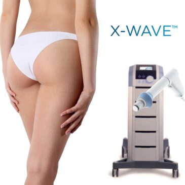 X-Wave™ Ciudad de México