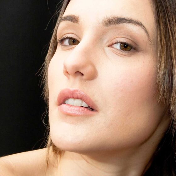 Armonización Facial, Treatment